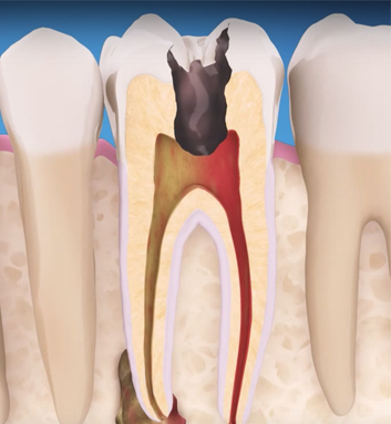 ΕΝΔΟΔΟΝΤΙΑ