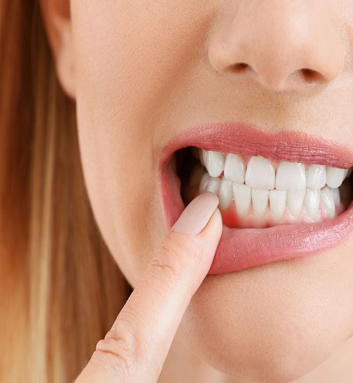 ΠΕΡΙΟΔΟΝΤΟΛΟΓΙΑ